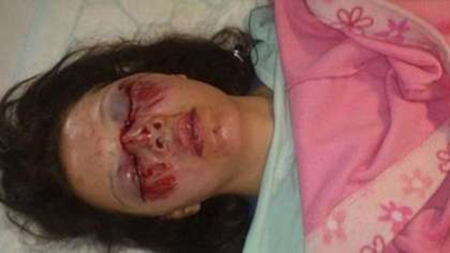 救人一命的安全配备也可能造成人命伤亡？