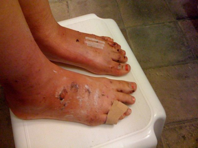 把脚放在 dashboard 上很舒服?她的经历告诉你别这样做!