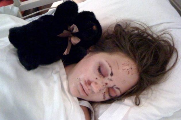 把脚放在 dashboard 上很舒服?她的经历告诉你别这样做!